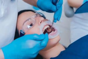 Root Canal Treatment