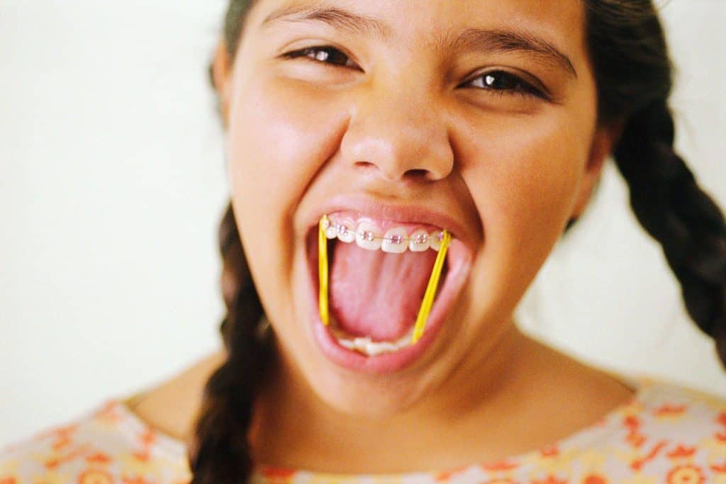 Smiling young girl showing her orthodontic braces, promoting oral health with Los Algodones Dentists Guide