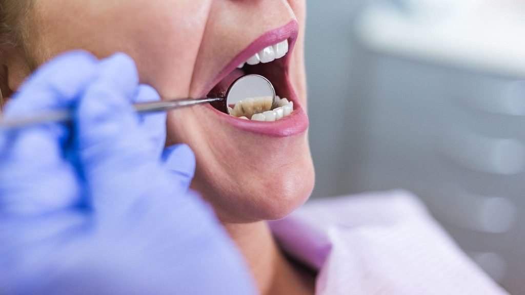 Patient receiving a dental checkup in a clinic